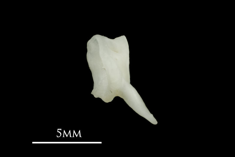 Roach first vertebra lateral view