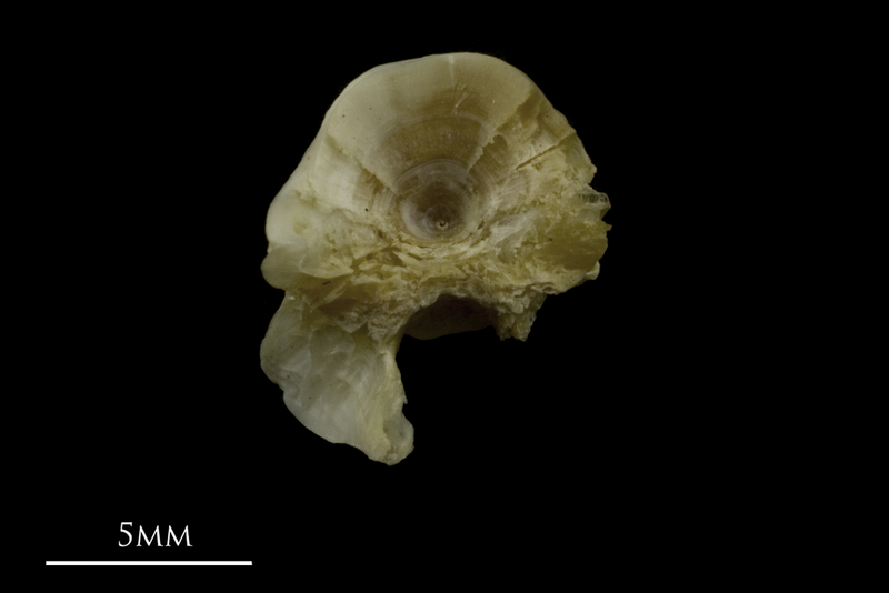 Zander first vertebra anterior view