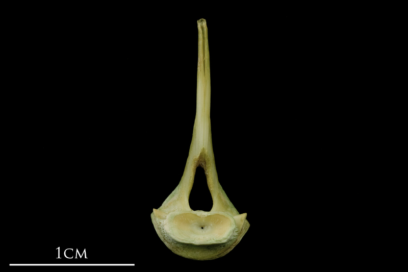 John dory first vertebra posterior view