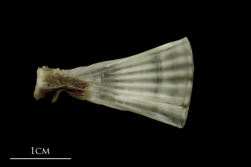 Brill ultimate vertebra lateral view