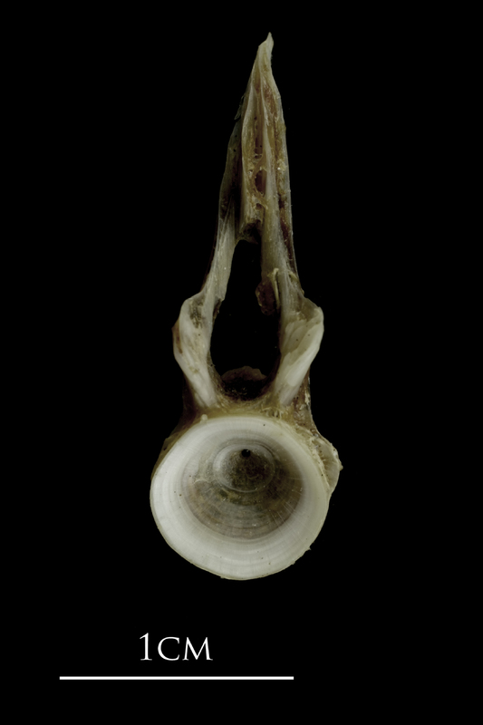 Brill first vertebra anterior view