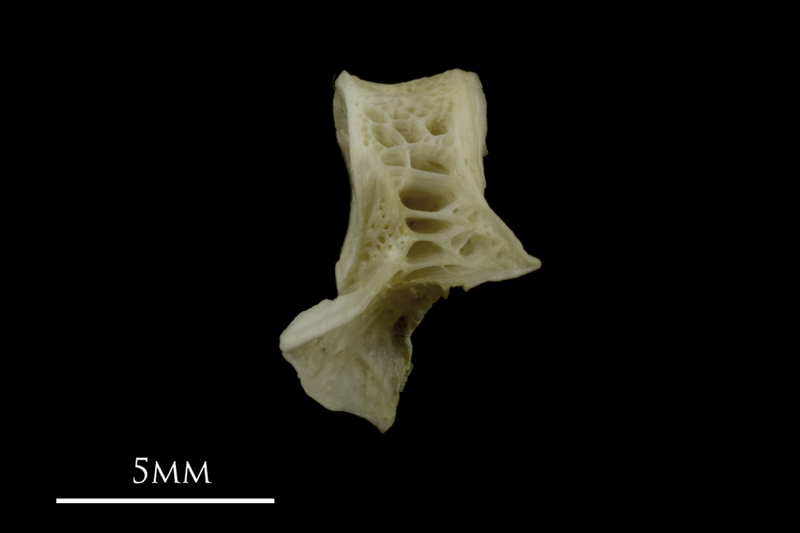 Zander first vertebra lateral view