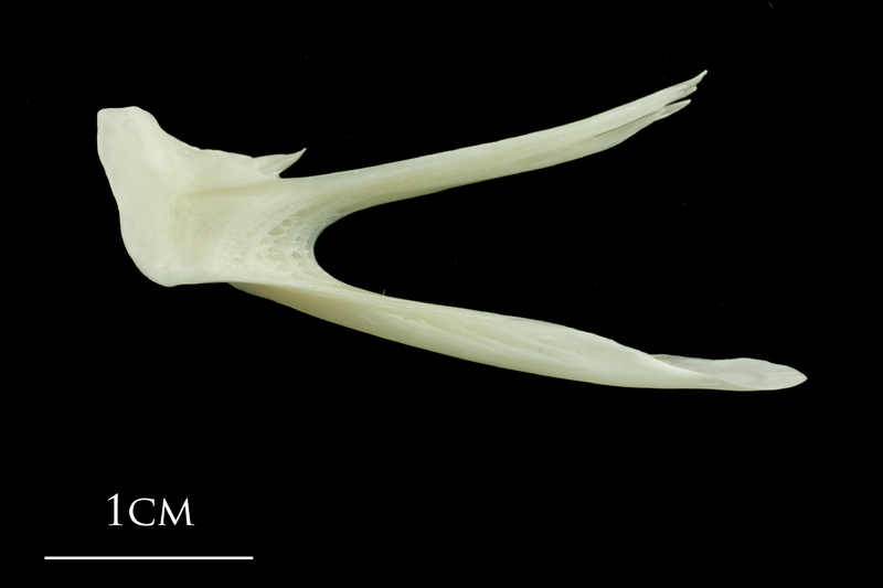 Pollack posttemporal medial view