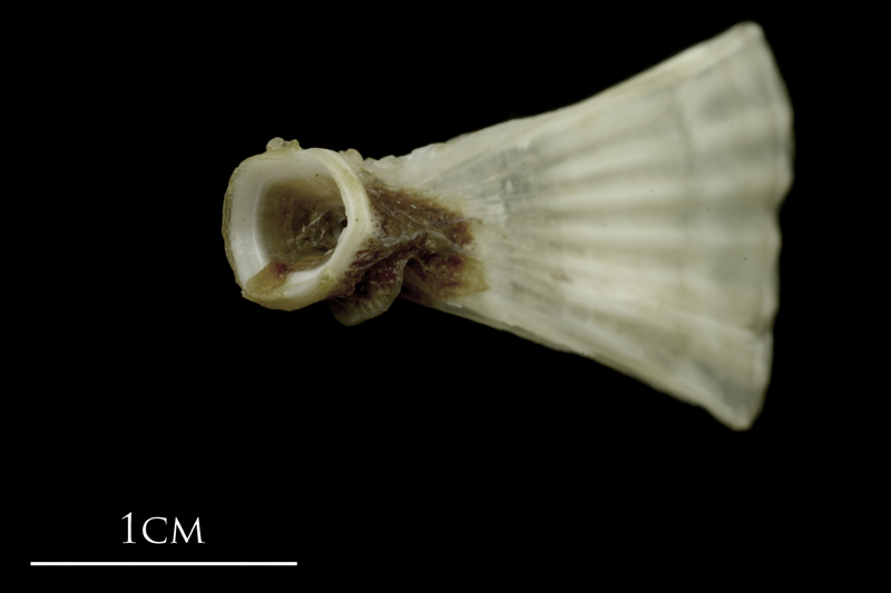 Brill ultimate vertebra anterior view