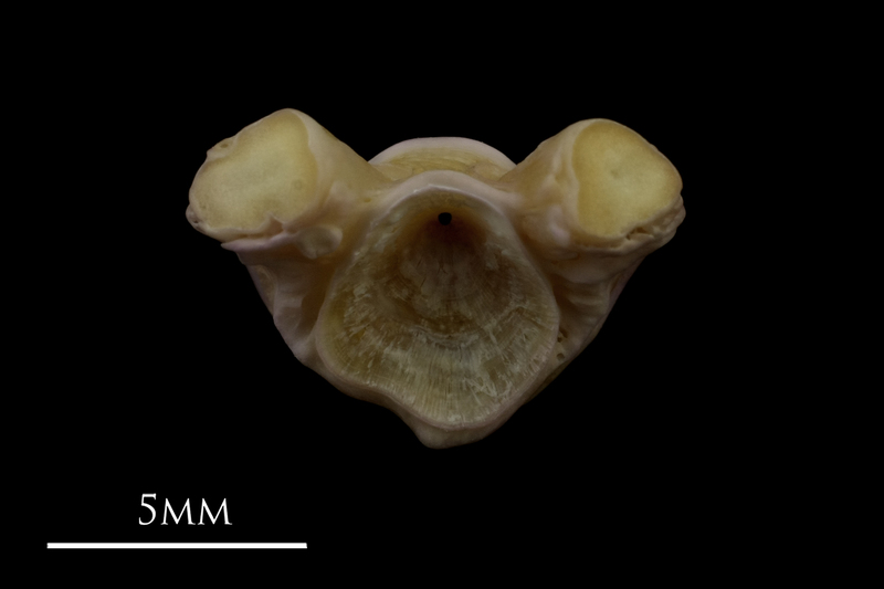 Tub gurnard first vertebra anterior view