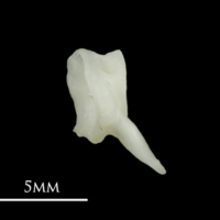 photo of Roach first vertebra lateral view