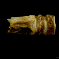 photo of Northern pike basioccipital - first vertebra lateral view
