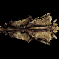 photo of Greater amberjack parasphenoid basioccipital vomer complex ventral view