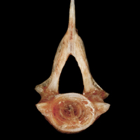 photo of Sea scorpion precaudal vertebra anterior view