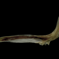 photo of Brill cleithrum medial view