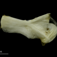 photo of Grey Triggerfish ceratohyal epihyal complex lateral view