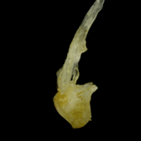 photo of Ruffe first vertebra lateral view