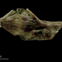 photo of Brill ceratohyal epihyal complex medial view