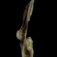 photo of Brill first vertebra lateral view