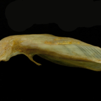 photo of Thinlip grey mullet  cleithrum dorsal view