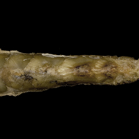 photo of Greater amberjack scute ventral view