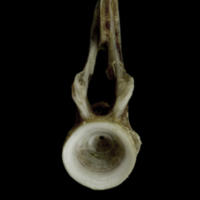 photo of Brill first vertebra anterior view