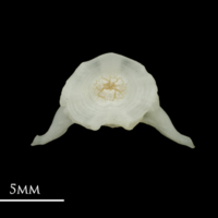 photo of Roach first vertebra anterior view