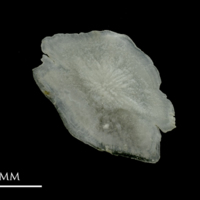 photo of Grey Triggerfish otolith(s) detail view