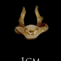 photo of Sea scorpion first vertebra posterior view