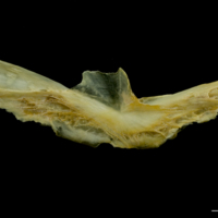 photo of Saithe preopercular medial view