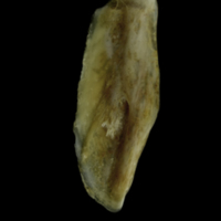 photo of Couch's seabream supracleithrum medial view