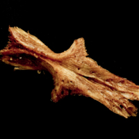 photo of Catfish parasphenoid ventral view