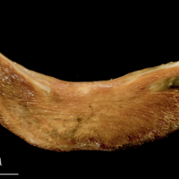 photo of Catfish preopercular medial view