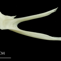 photo of Pollack posttemporal medial view