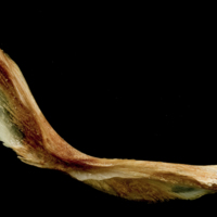photo of Catfish cleithrum medial view