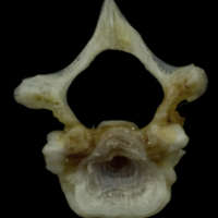 photo of Red gurnard first vertebra anterior view
