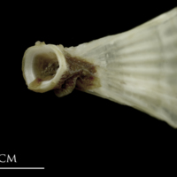 photo of Brill ultimate vertebra anterior view