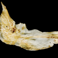 photo of Atlantic salmon cleithrum medial view