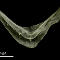 photo of Sandsmelt for assessment medial view