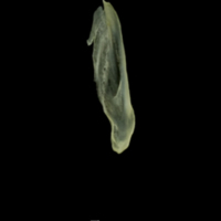 photo of Butterfish supracleithrum medial view
