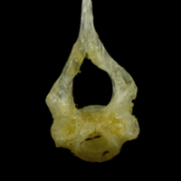 photo of Ruffe first vertebra anterior view